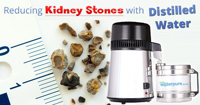 Reducing kidney stones with distilled water